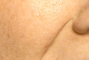 中醫美妍針-文章圖片06