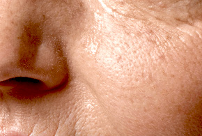 中醫美妍針-文章圖片05