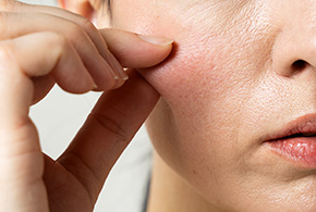 中醫美妍針-文章圖片04